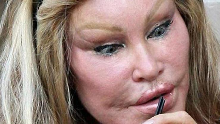 Jocelyn Wildenstein