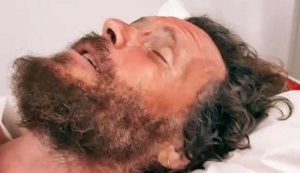 Jovanotti in ospedale